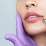 dermal filler