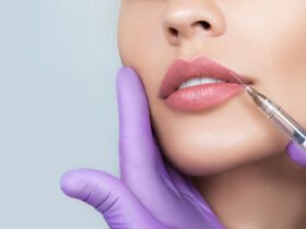 dermal filler